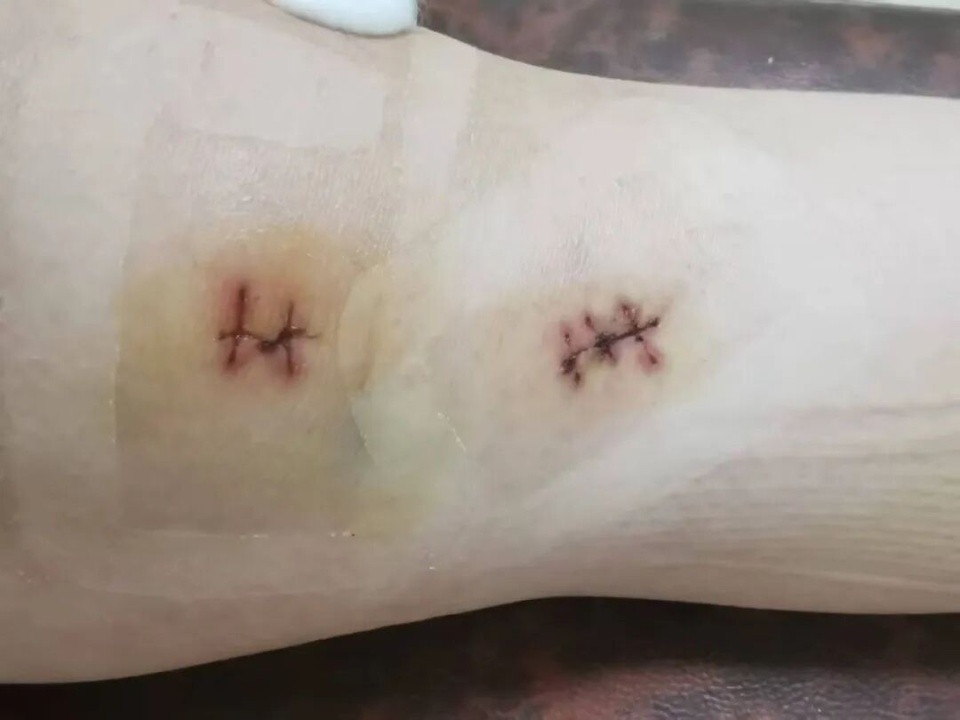可赛后不久